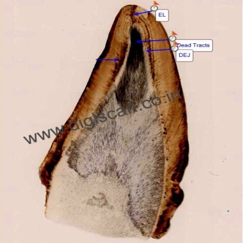 BDS Complete Digital Slides Set (Histology, Dental Anatomy & Oral Pathology)
